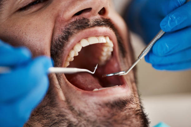 Best Broken or Chipped Tooth Repair in Bonita Springs, FL